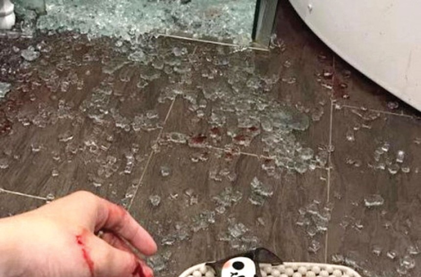 Chủ nhân căn hộ bị thương do kính cường lực trong nhà tắm nổ. Ảnh: Nguyễn Thành

